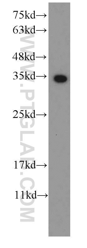 WB analysis of Recombinant protein using 66165-1-Ig