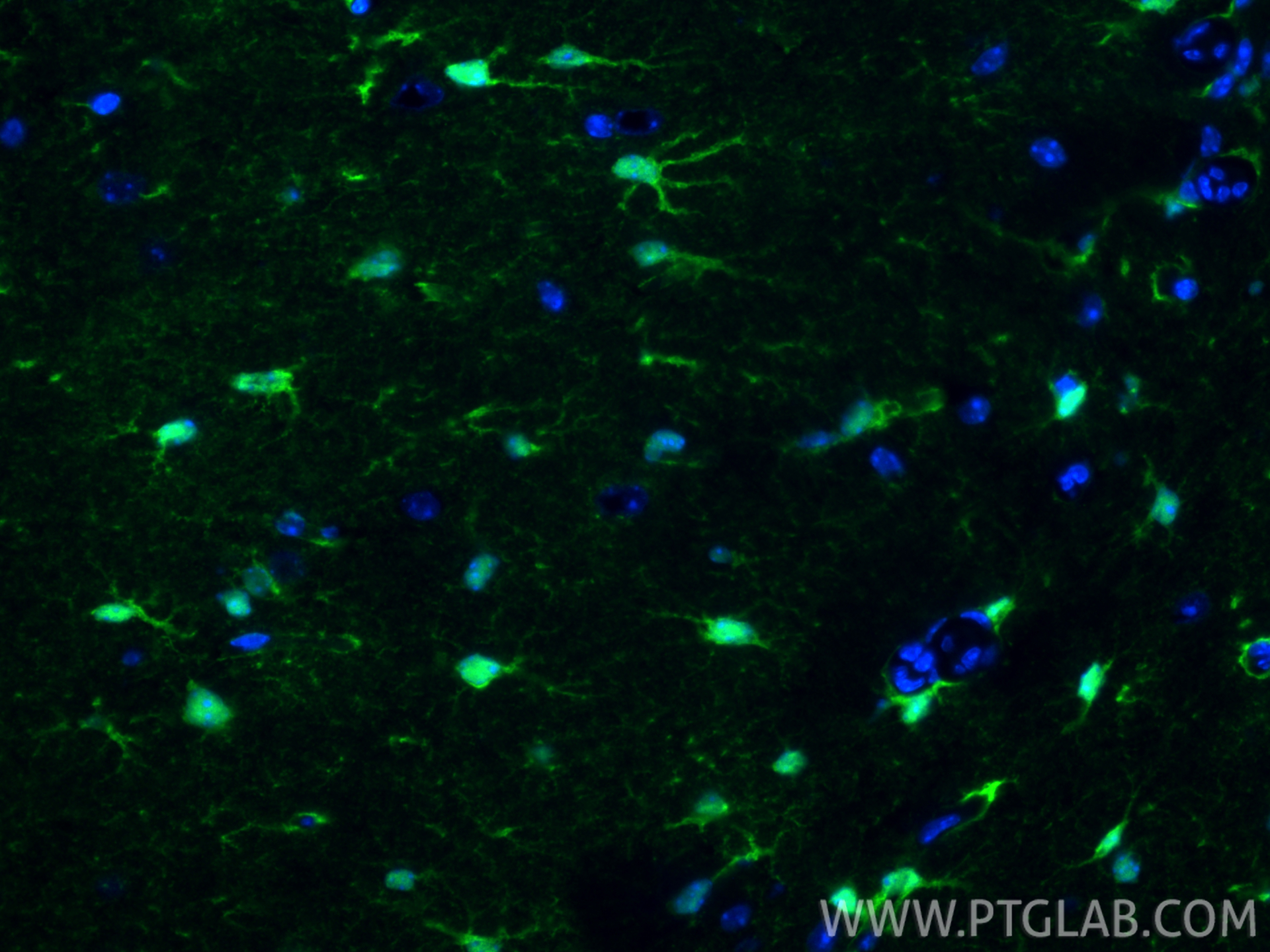 IF Staining of mouse brain using 82271-8-RR IF Staining of mouse brain using 82271-8-RR