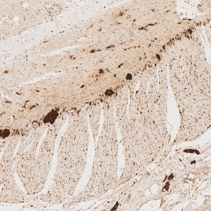 IHC staining of human small intestine using 82271-8-RR IHC staining of human small intestine using 82271-8-RR