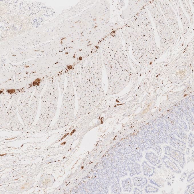 IHC staining of human small intestine using 82271-8-RR IHC staining of human small intestine using 82271-8-RR