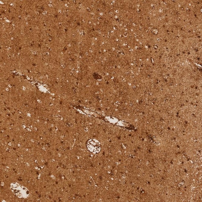IHC staining of human brain using 82271-8-RR IHC staining of human brain using 82271-8-RR
