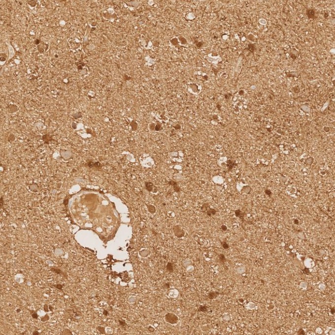 IHC staining of human brain using 82271-8-RR IHC staining of human brain using 82271-8-RR