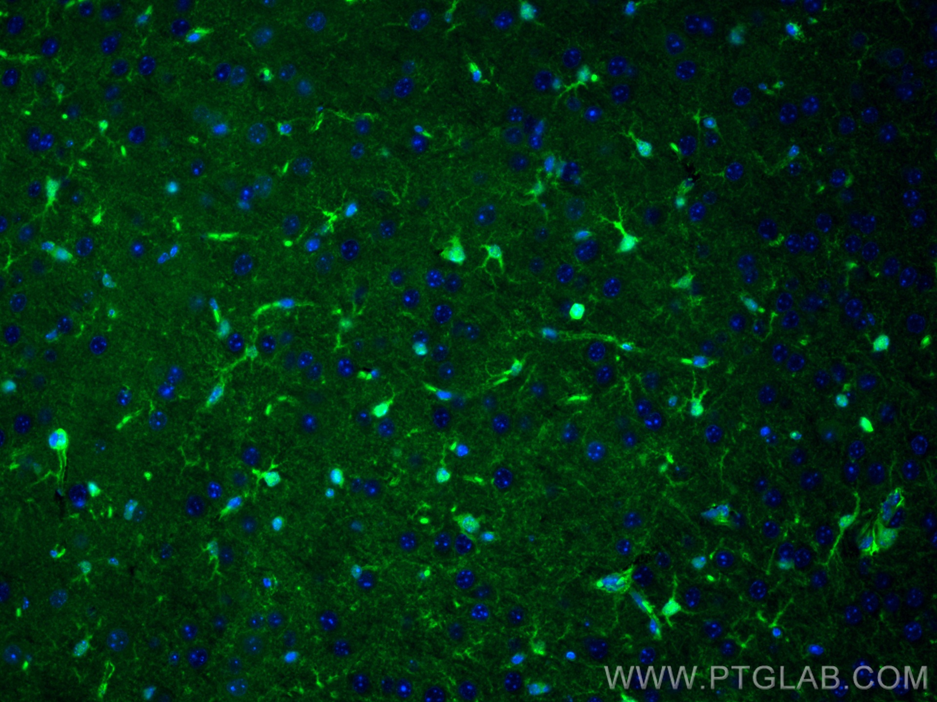IF Staining of mouse brain using CL488-15146