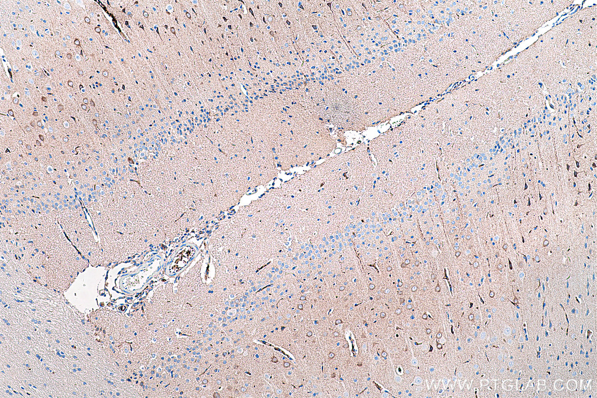 IHC staining of rat brain using 67237-1-Ig