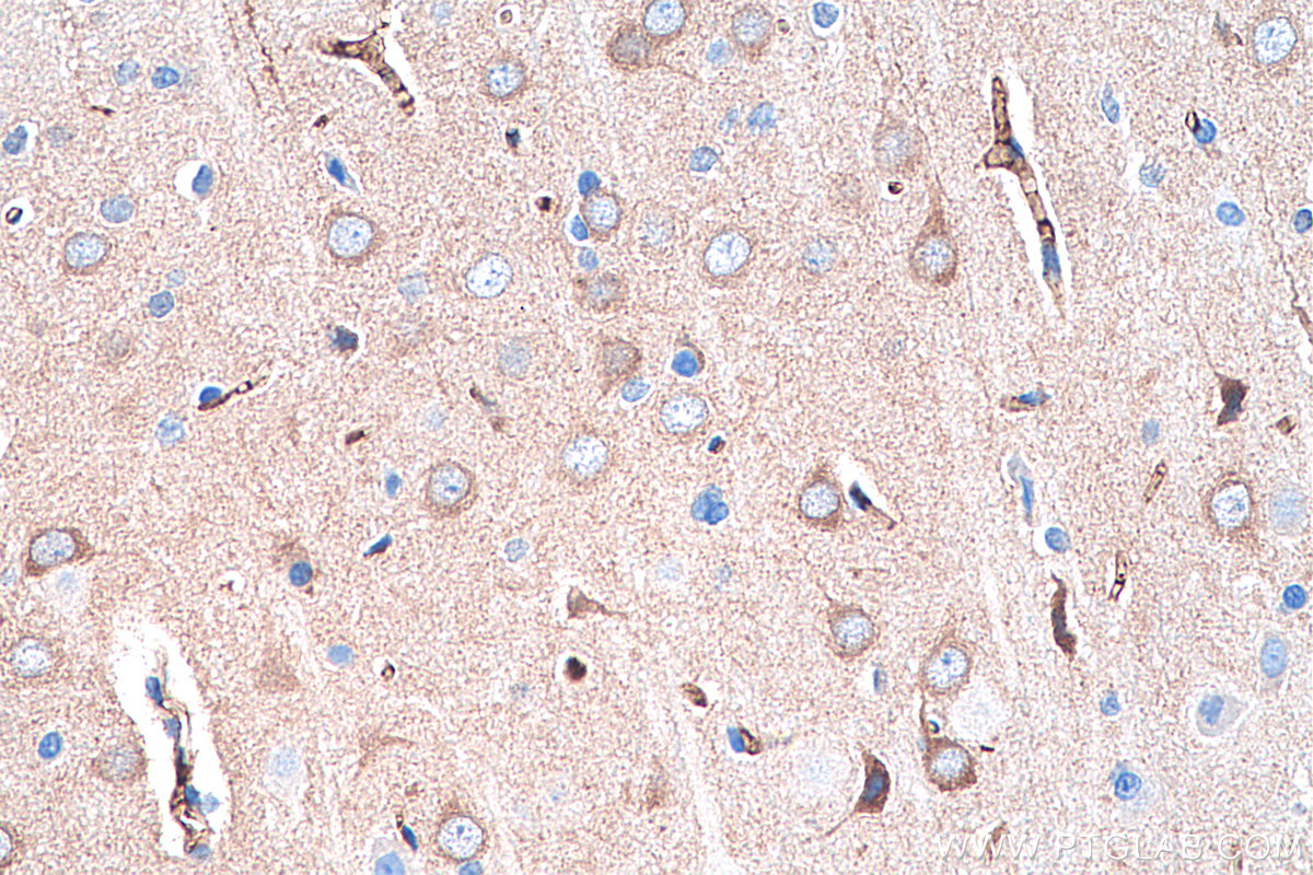 IHC staining of rat brain using 67237-1-Ig