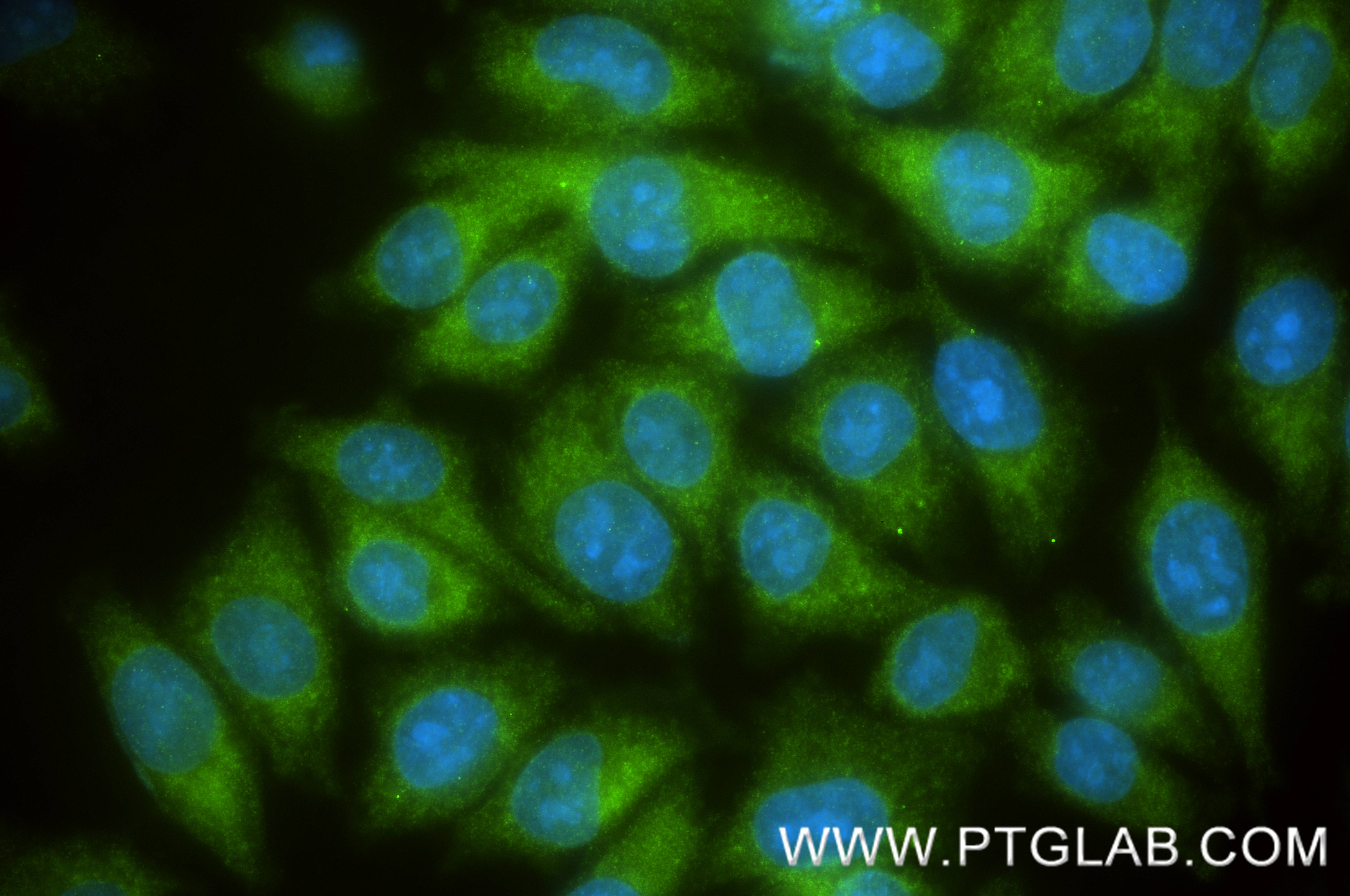 IF Staining of A375 using 88164-1-RR (same clone as 88164-1-PBS) IF Staining of A375 using 88164-1-RR (same clone as 88164-1-PBS)