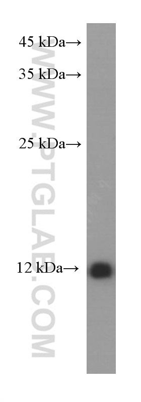 WB analysis of human lung using 66227-1-Ig