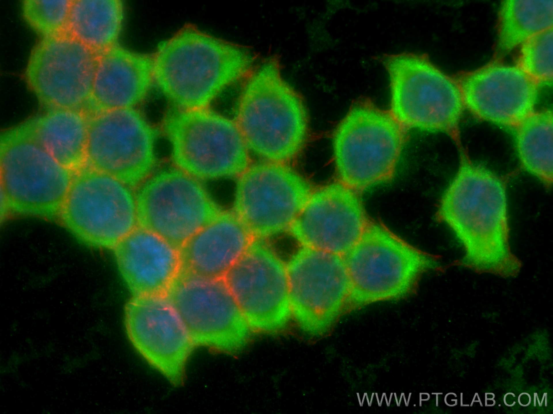 IF Staining of BxPC-3 using 10237-1-AP