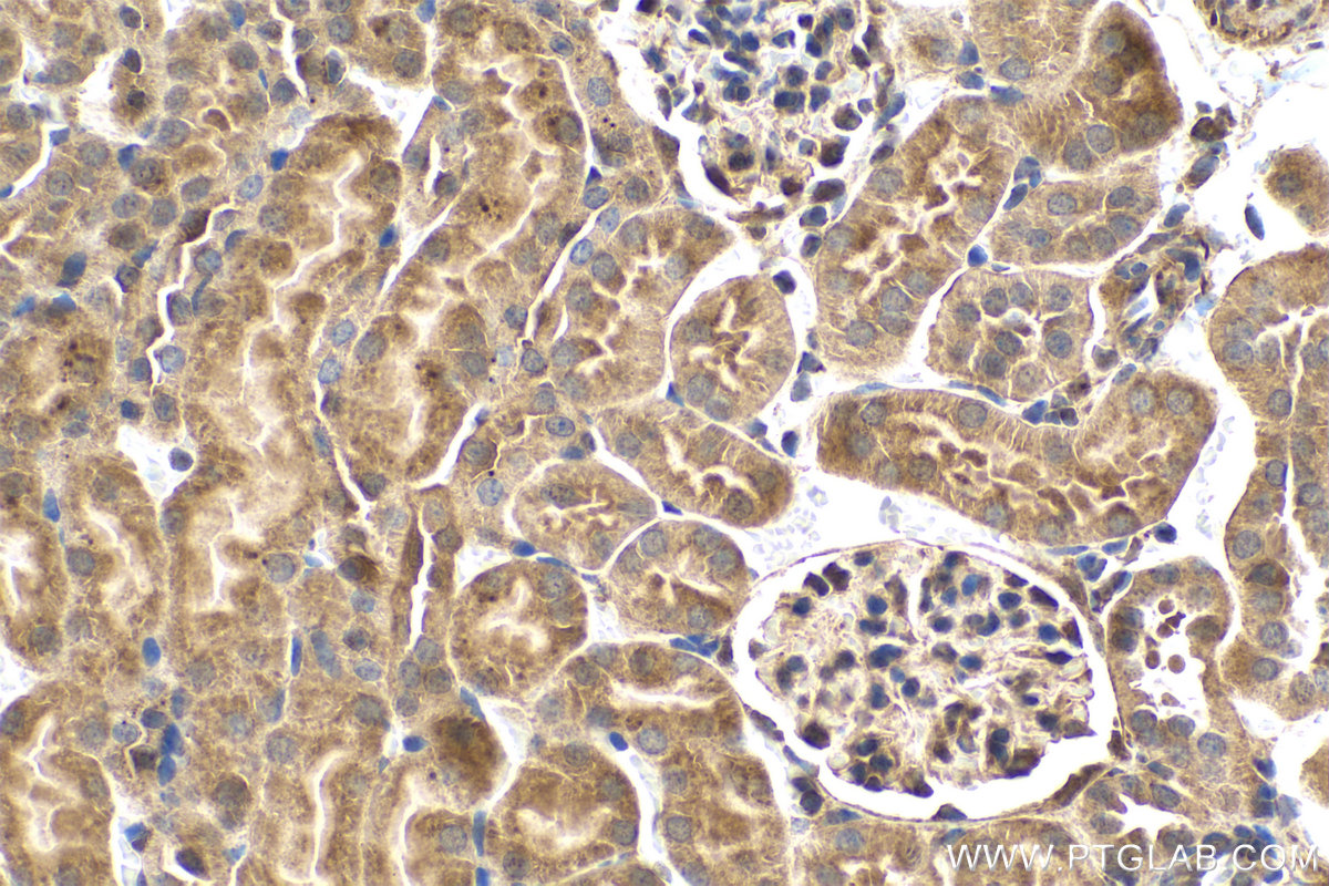 IHC staining of mouse kidney using 10237-1-AP