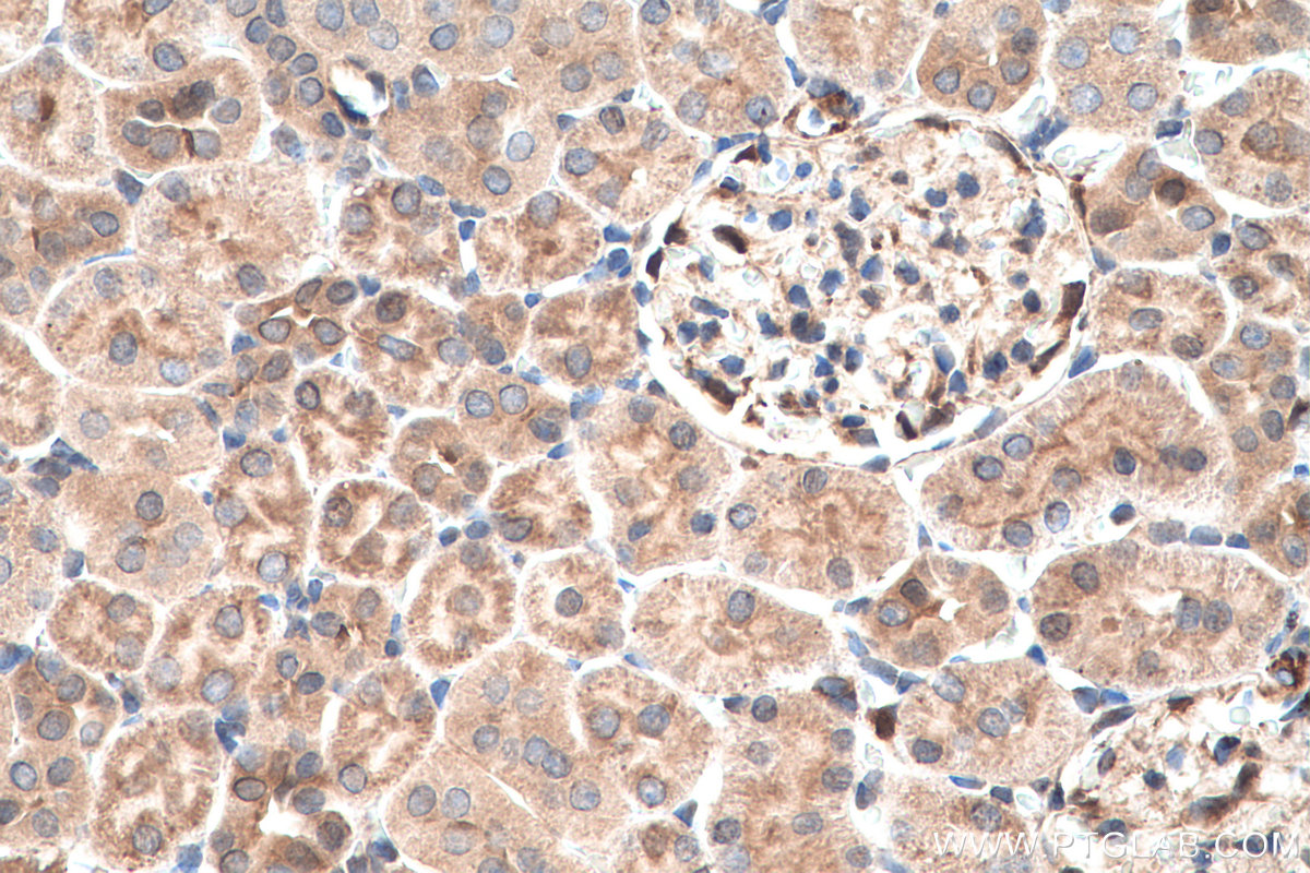 IHC staining of rat kidney using 10237-1-AP
