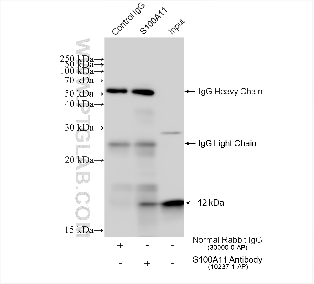 IP experiment of DU 145 using 10237-1-AP