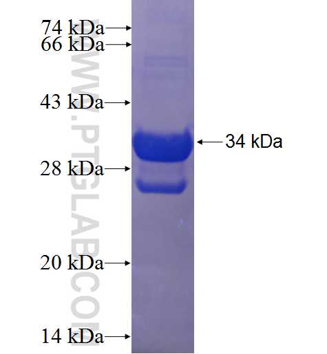S100A12 fusion protein Ag9961 SDS-PAGE