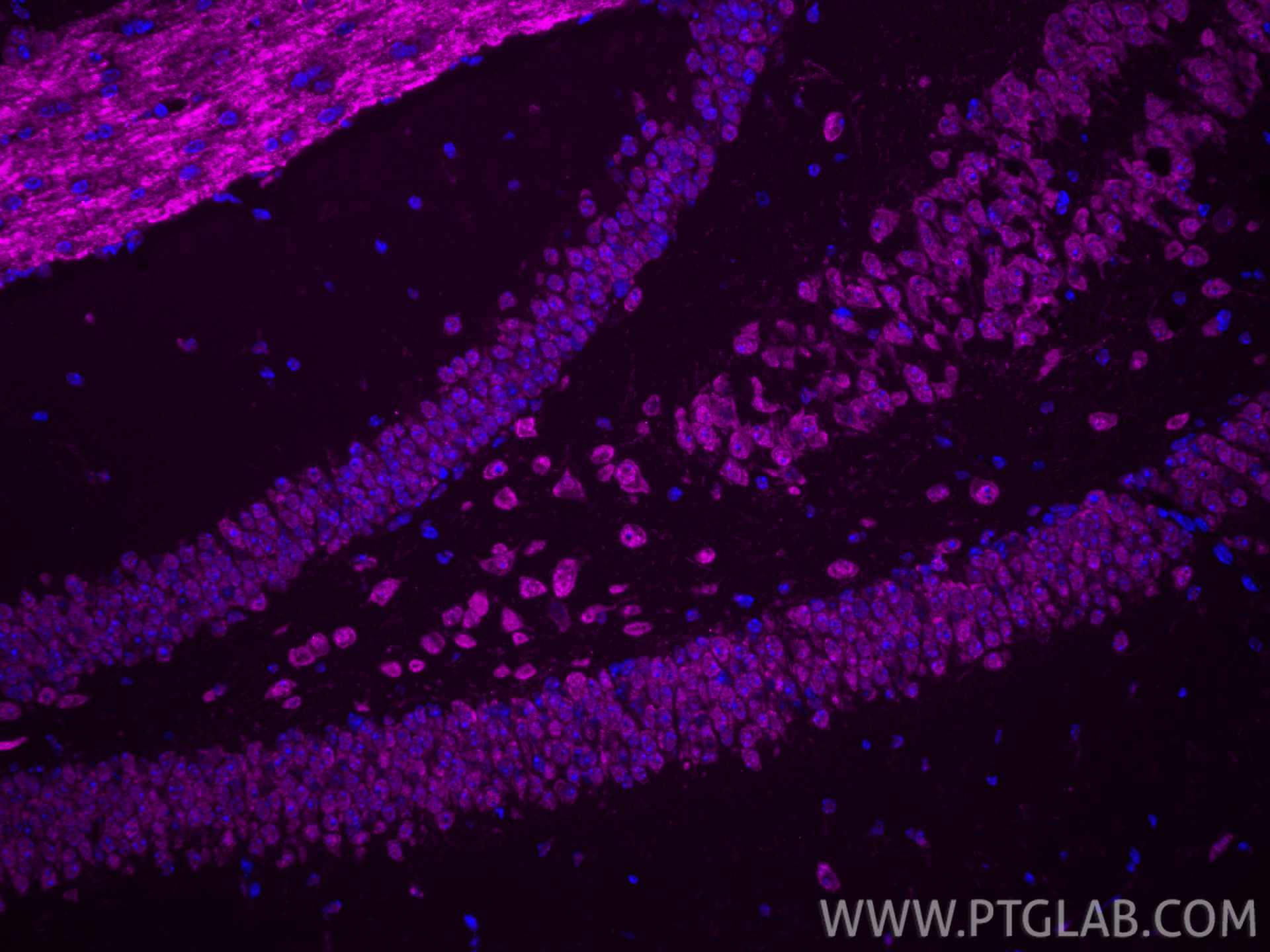 IF Staining of mouse brain using CL647-14987 IF Staining of mouse brain using CL647-14987