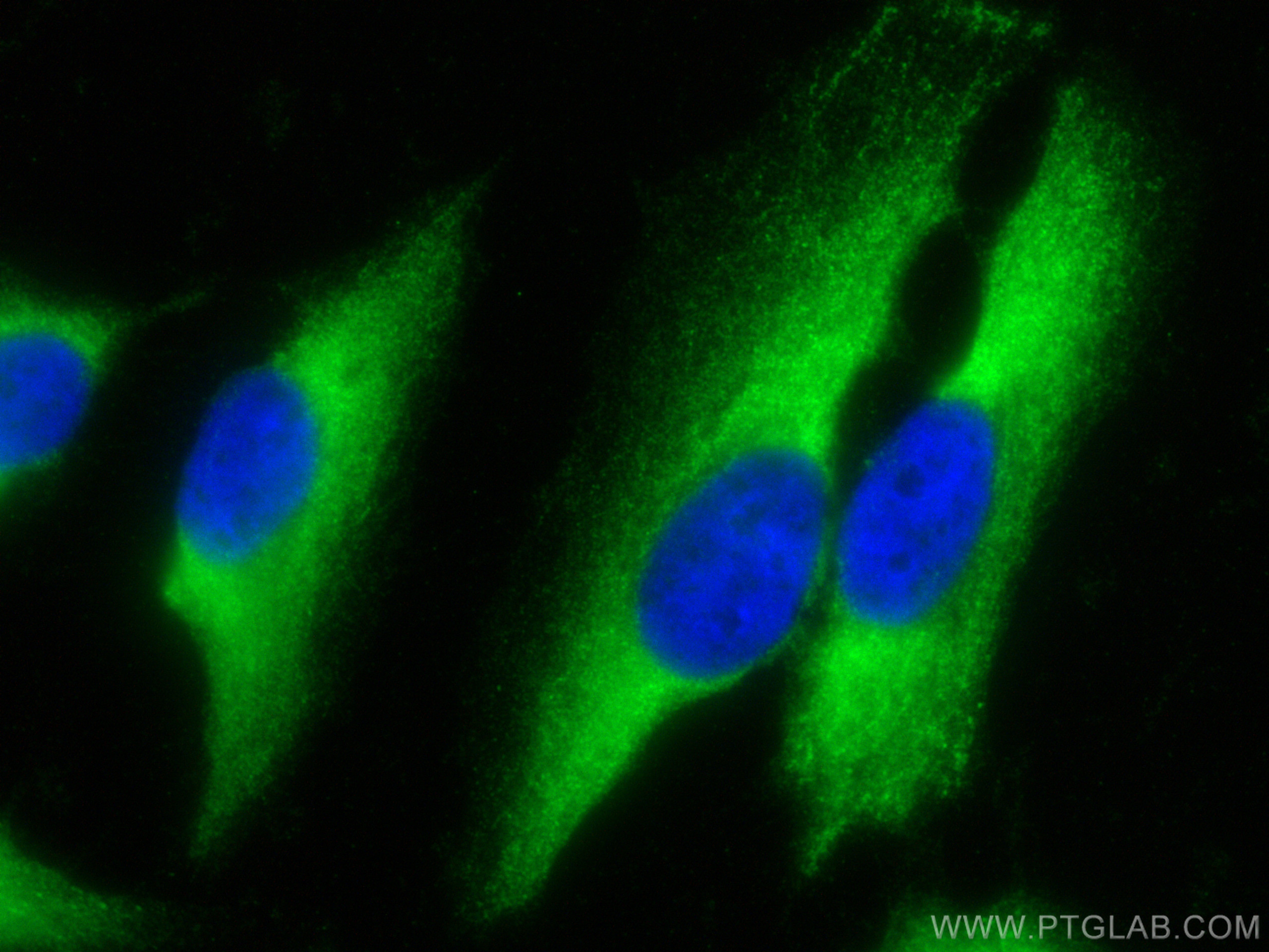 IF Staining of HeLa using 10489-1-AP