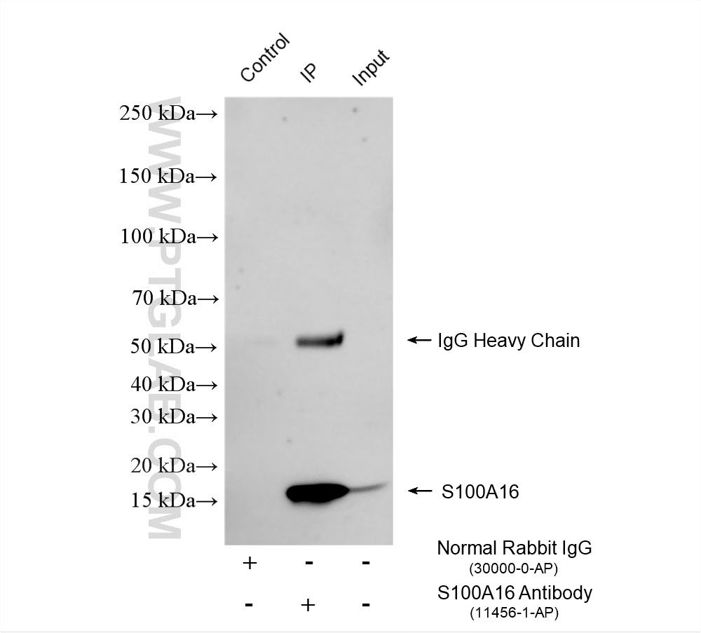 IP experiment of mouse brain using 11456-1-AP IP experiment of mouse brain using 11456-1-AP