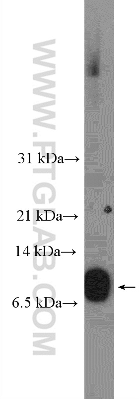 WB analysis of A431 using 11456-1-AP