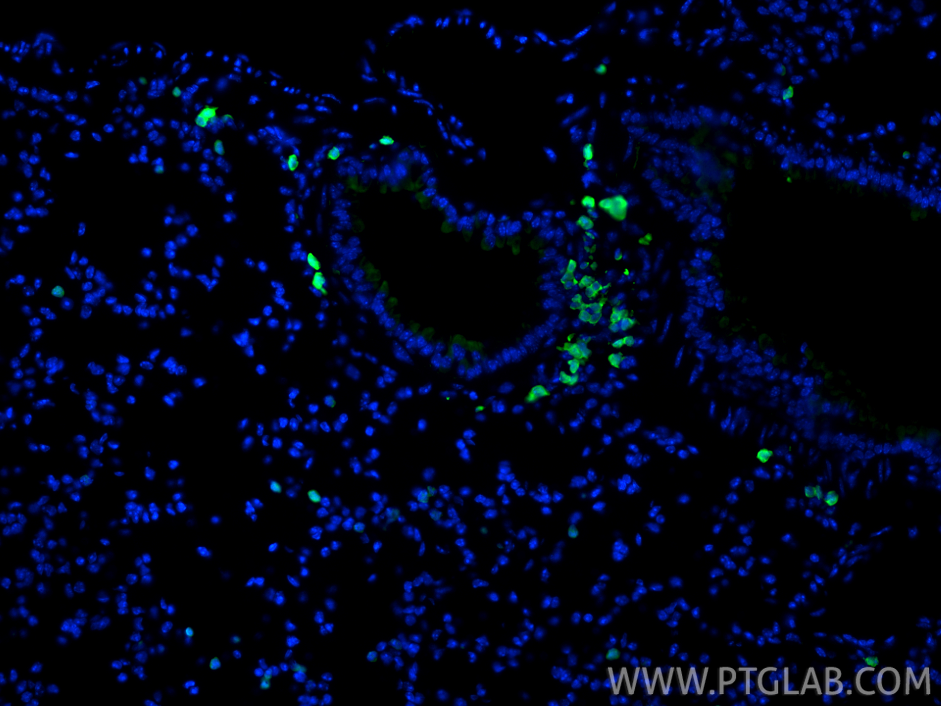 IF Staining of mouse lung using 16105-1-AP