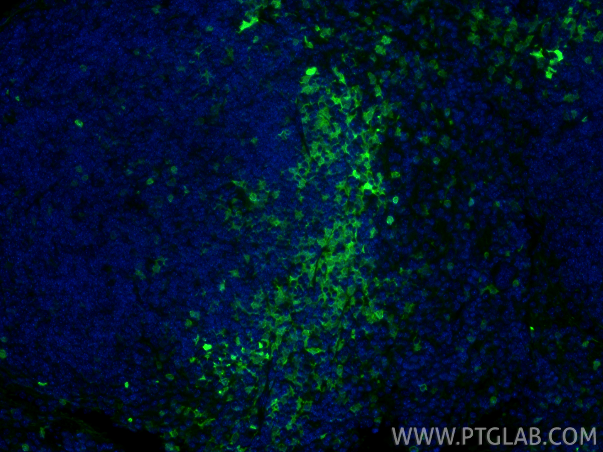 IF Staining of mouse spleen using 16105-1-AP