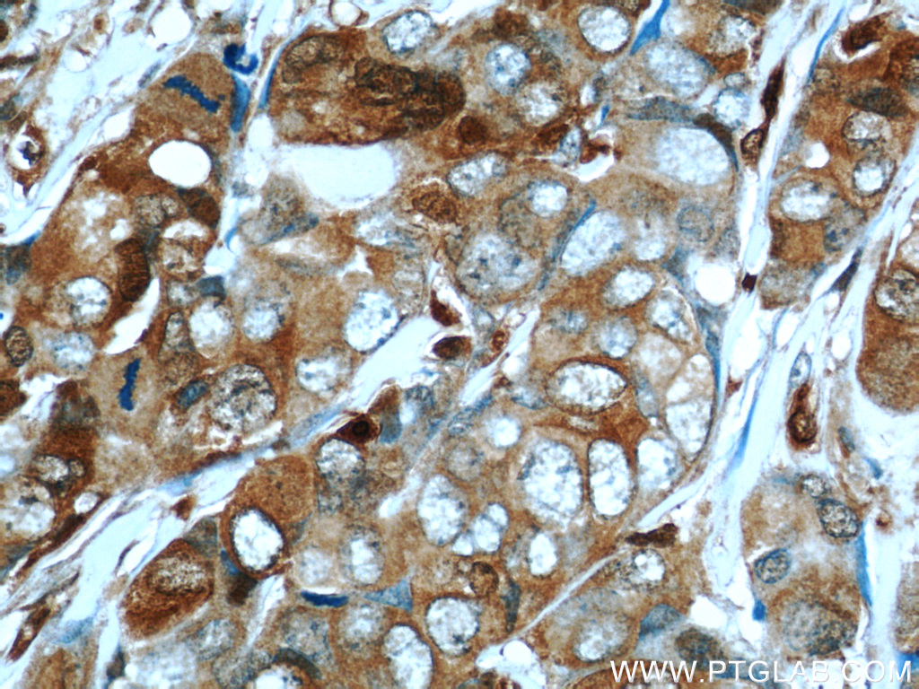 S100A4 Polyclonal antibody