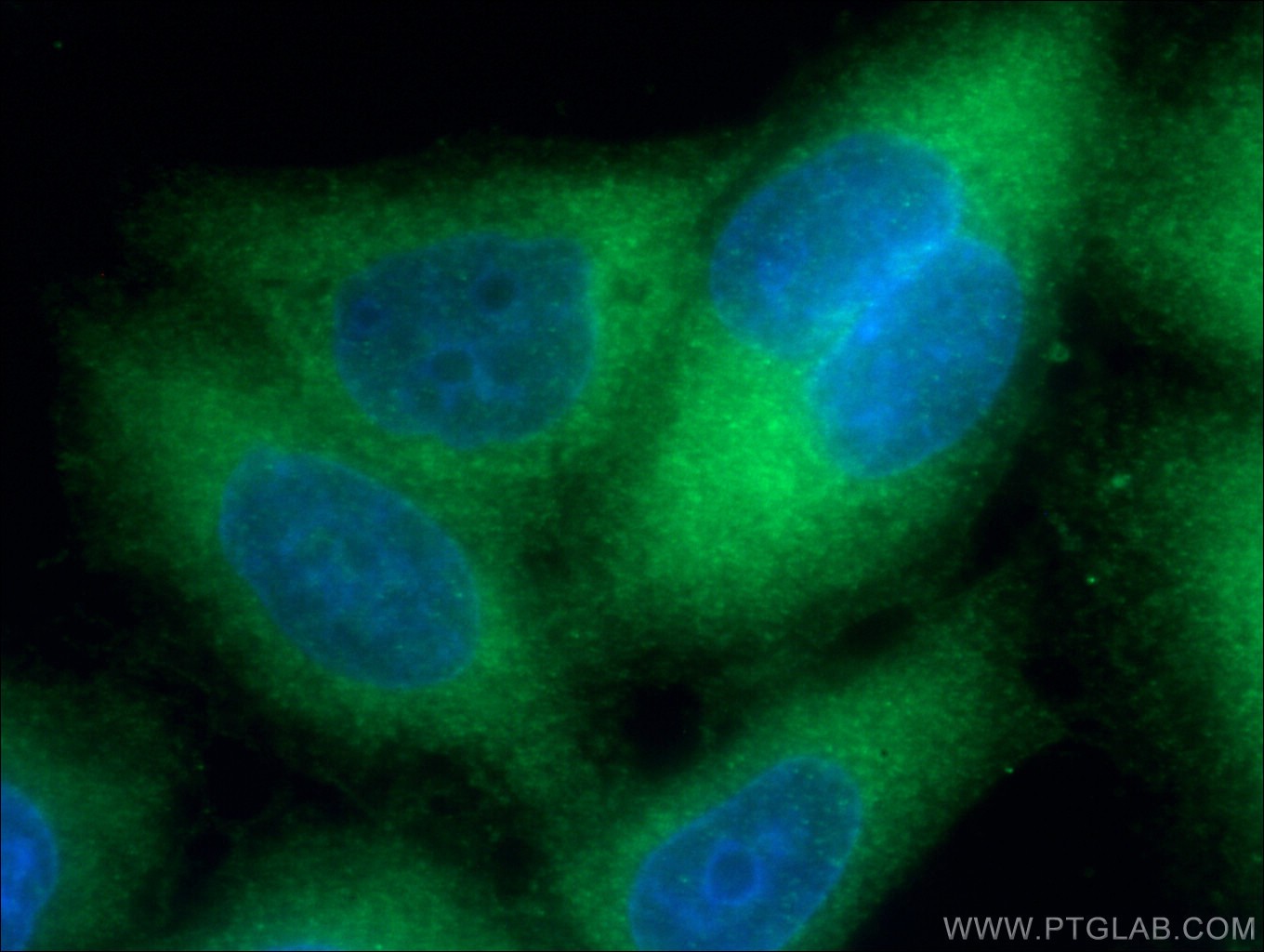 IF Staining of HeLa using 66489-1-Ig (same clone as 66489-1-PBS)