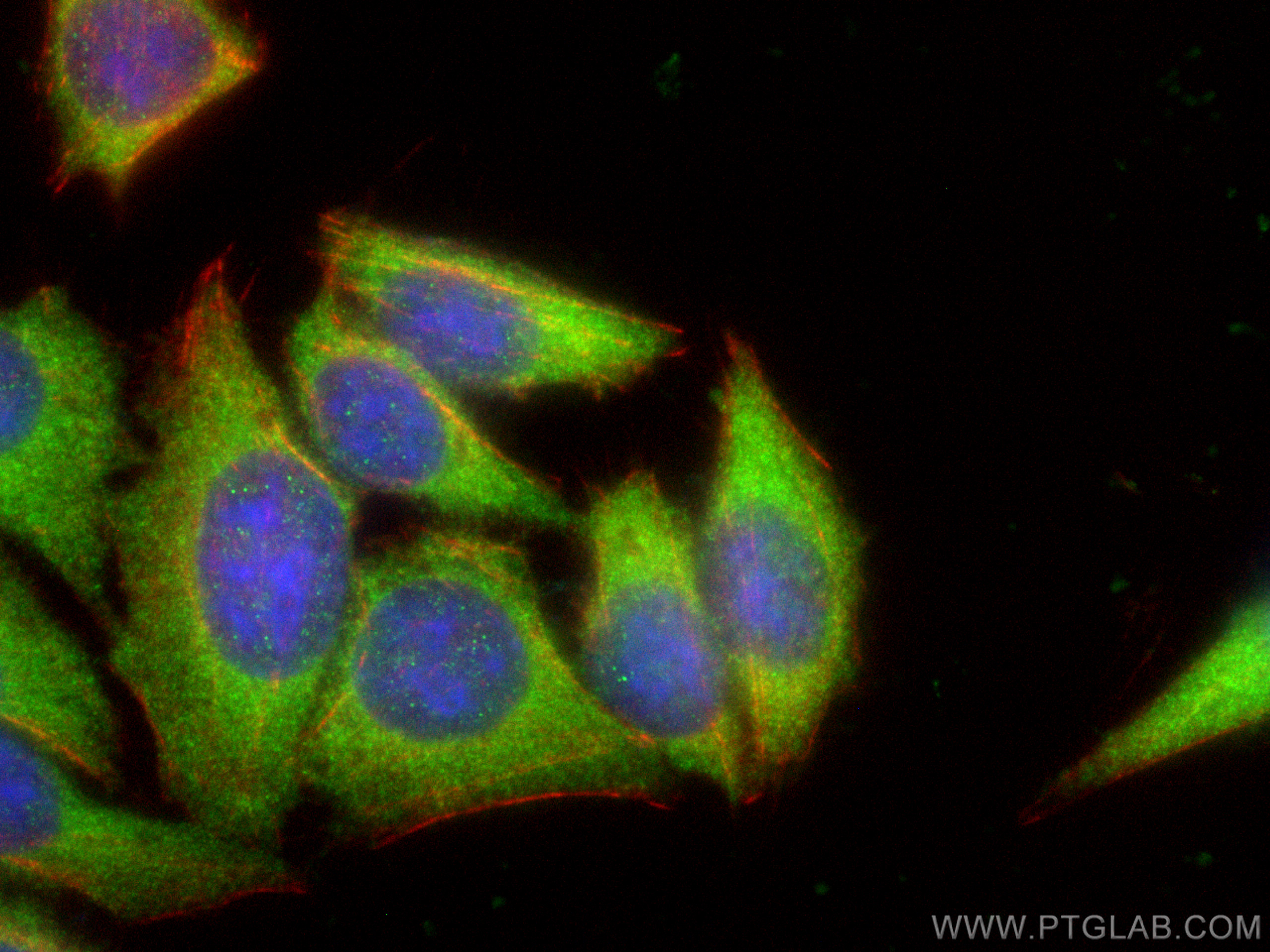 IF Staining of HepG2 using 66489-1-Ig (same clone as 66489-1-PBS)