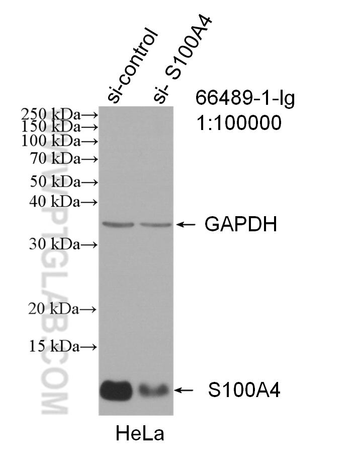 WB analysis of HeLa using 66489-1-Ig (same clone as 66489-1-PBS)