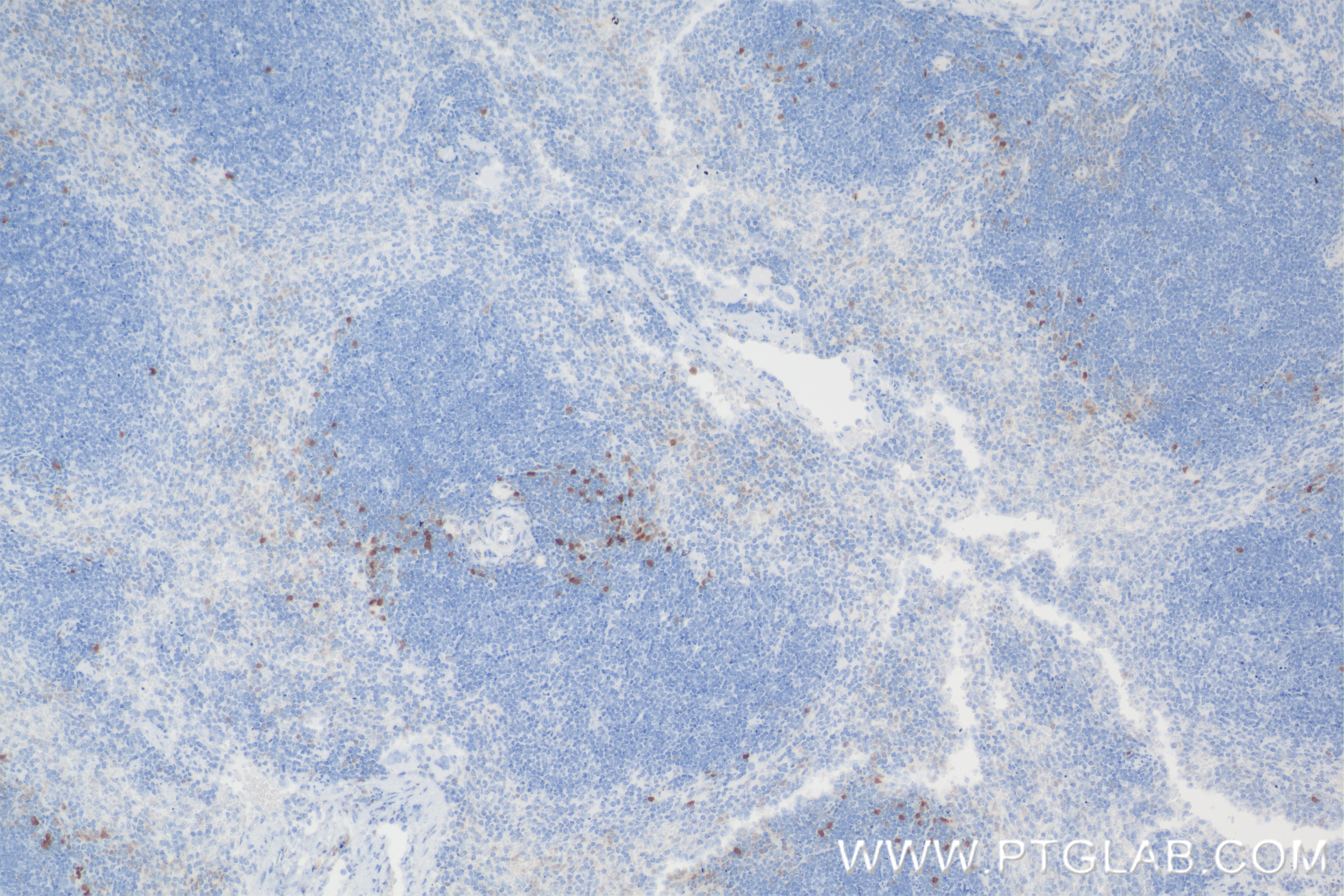 IHC staining of mouse spleen using 84221-1-RR