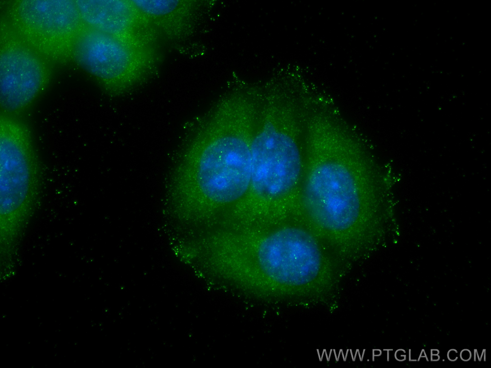 IF Staining of MCF-7 using 10245-1-AP