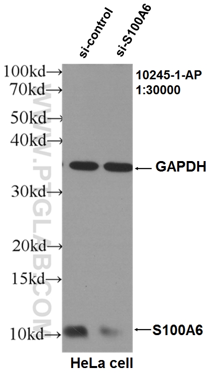 WB analysis of HeLa using 10245-1-AP