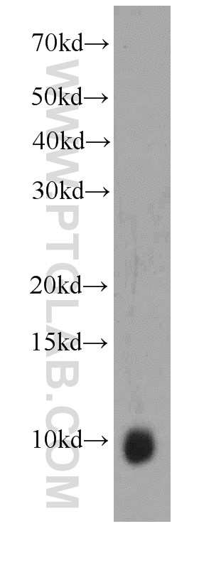 WB analysis of HeLa using 66098-1-Ig (same clone as 66098-1-PBS)