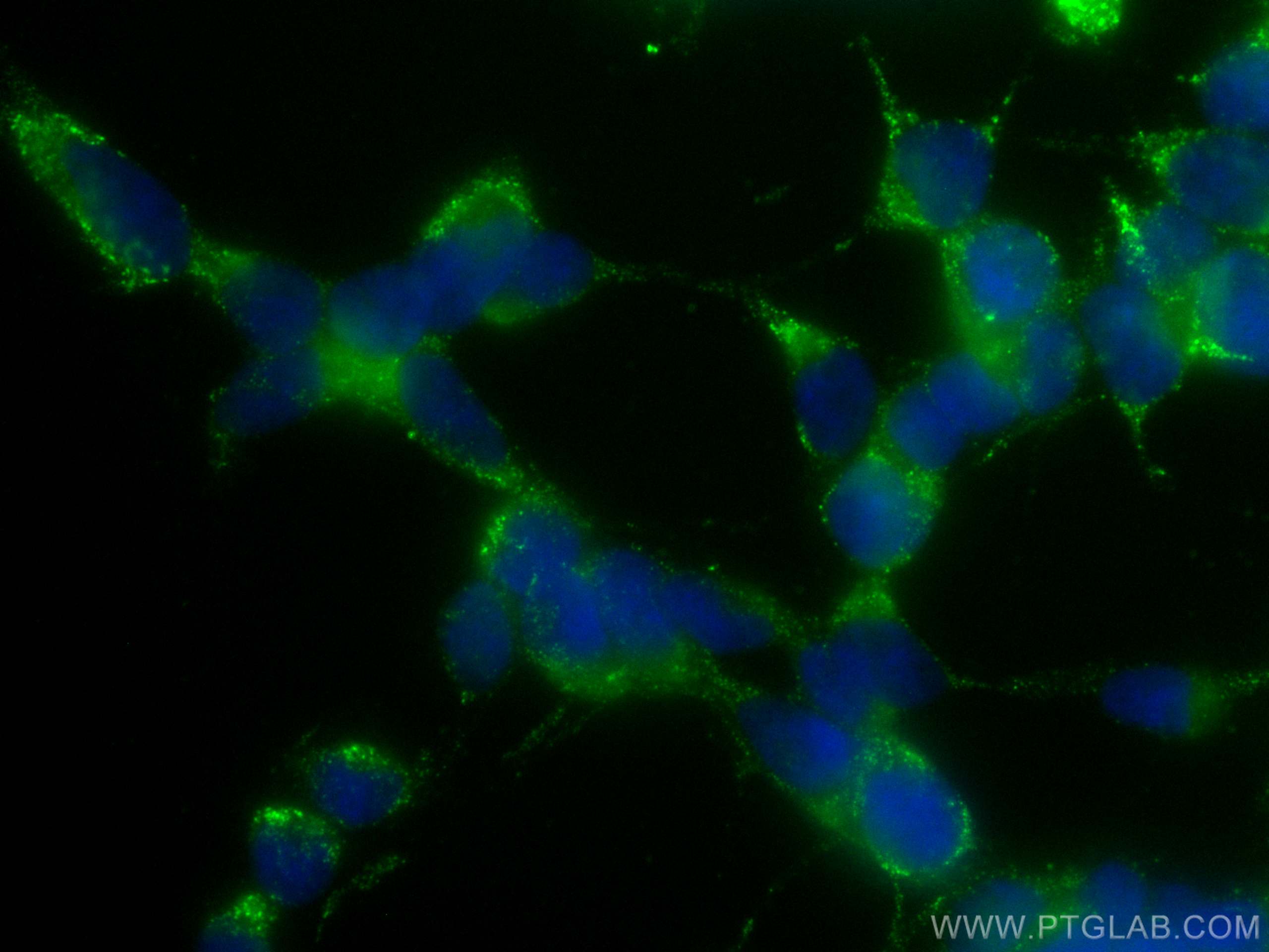 IF Staining of SH-SY5Y using CL488-66098