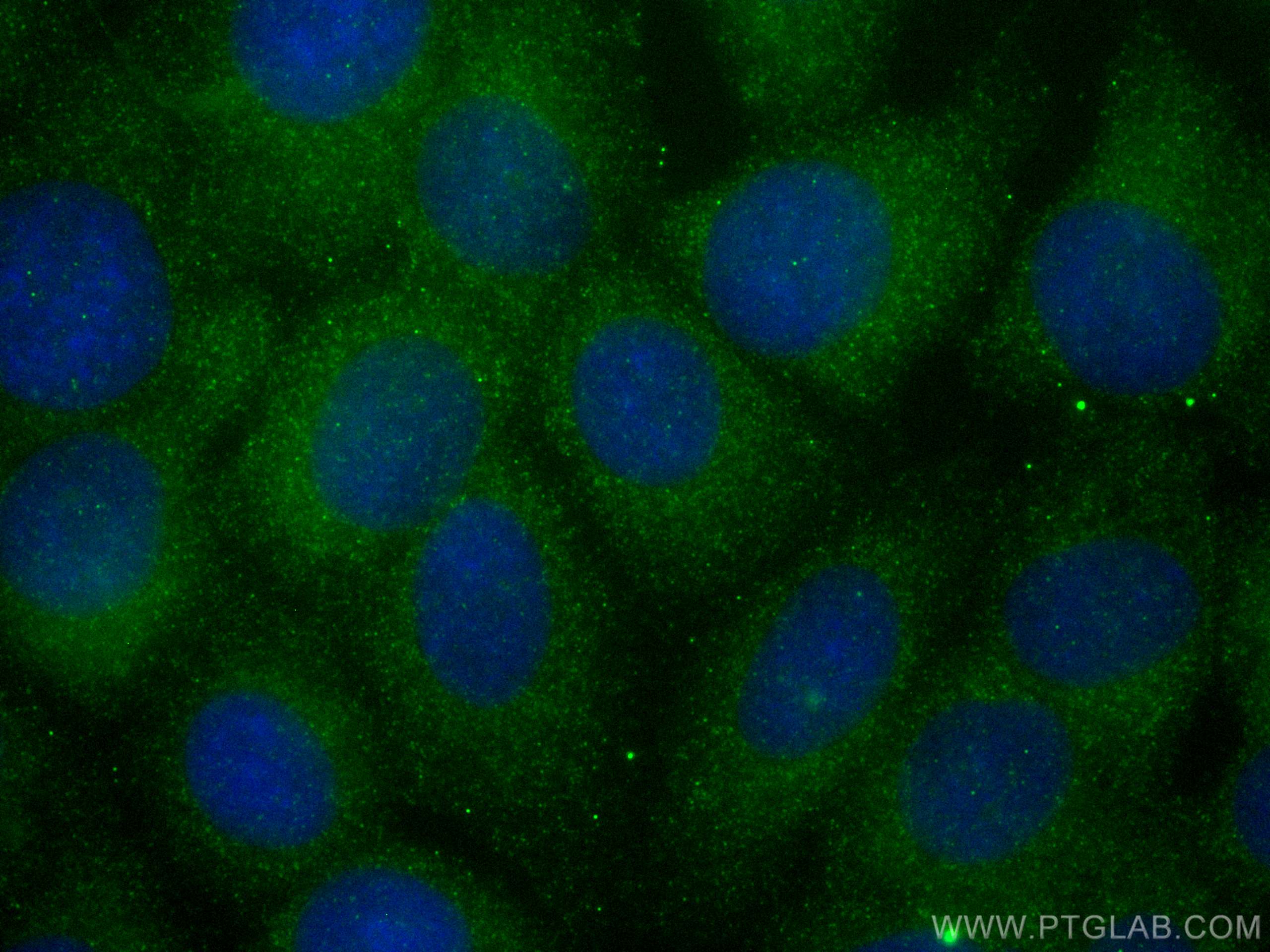 IF Staining of MCF-7 using 13061-1-AP (same clone as 13061-1-PBS)