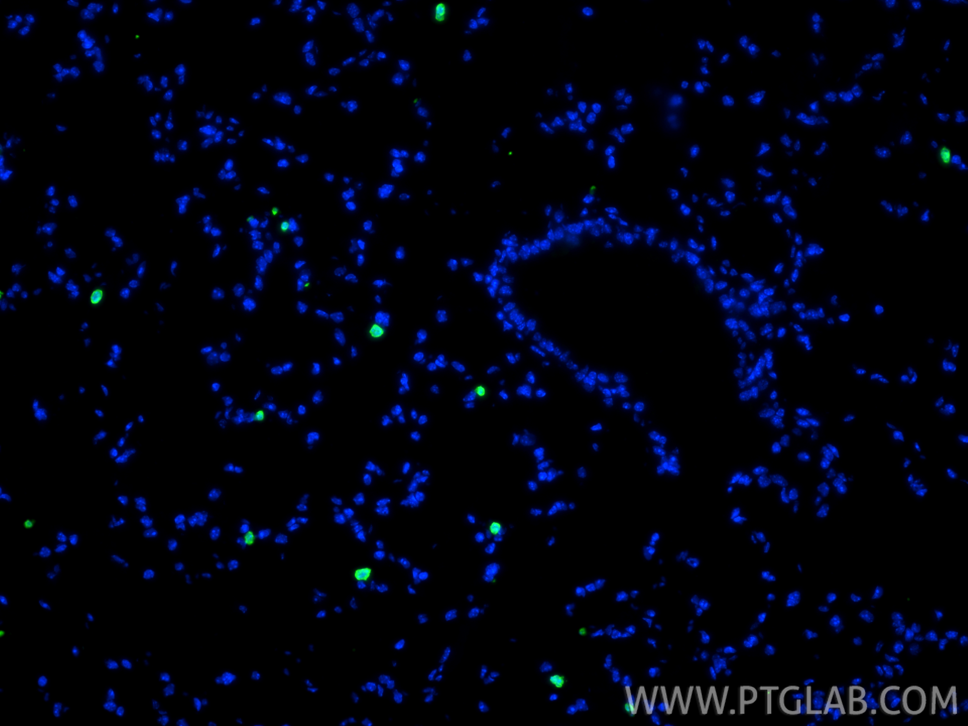 IF Staining of mouse lung using 15792-1-AP