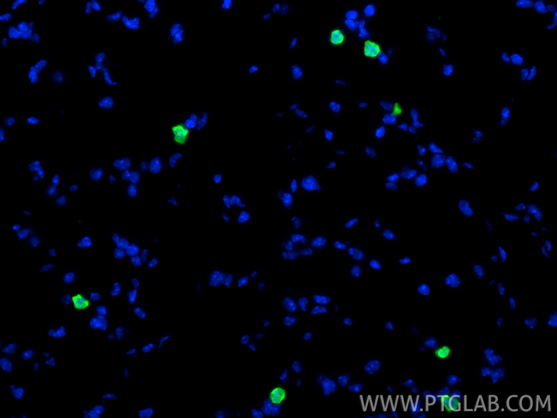 IF Staining of mouse lung using 15792-1-AP