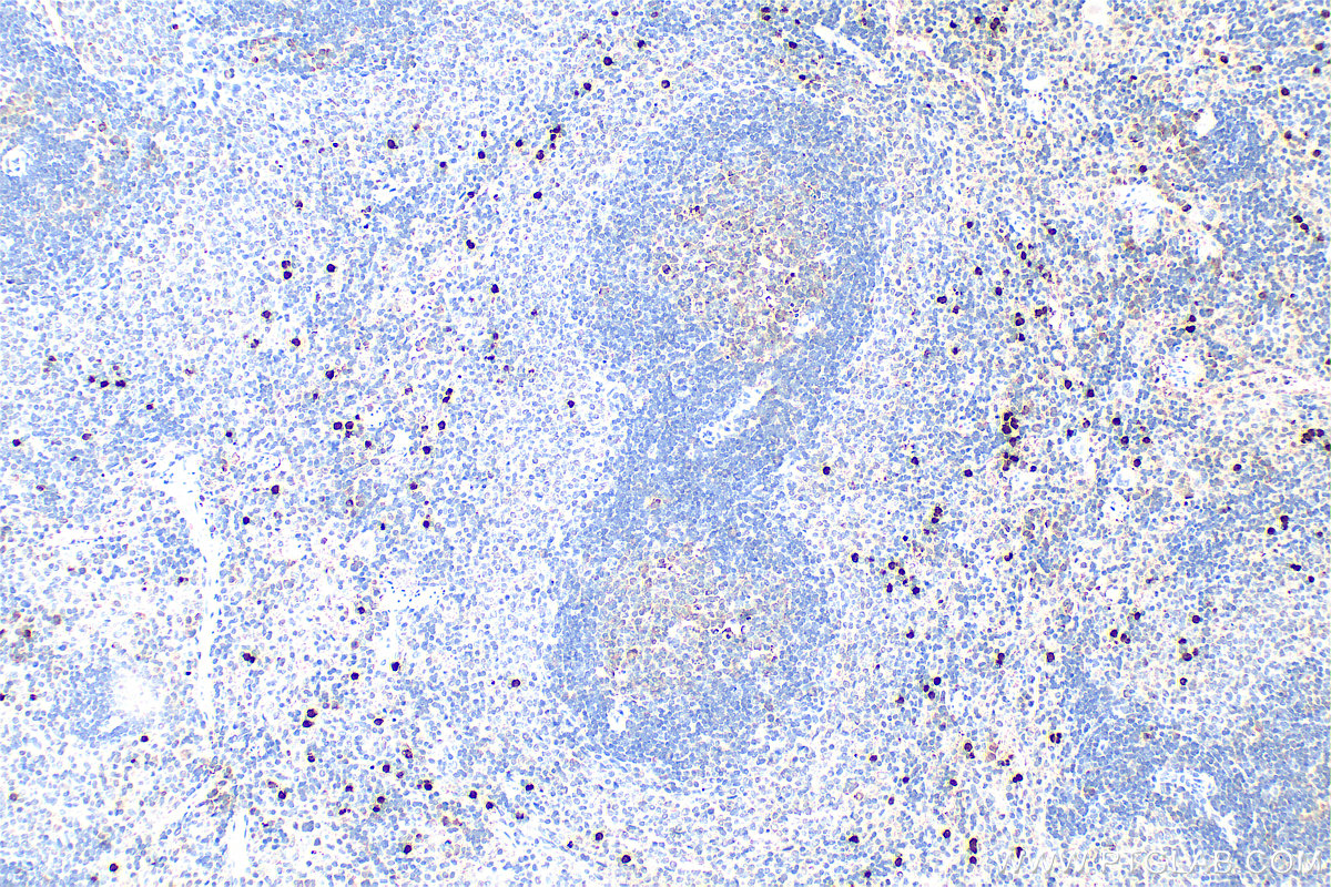 IHC staining of rat spleen using 15792-1-AP