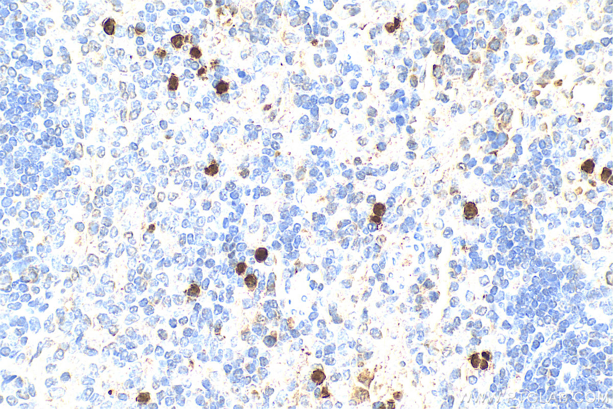 IHC staining of rat spleen using 15792-1-AP
