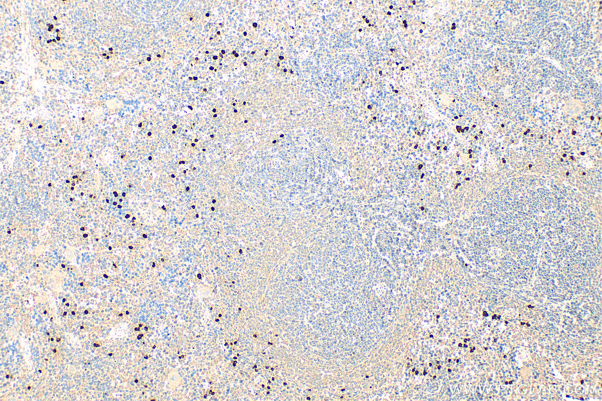 IHC staining of rat spleen using 15792-1-AP