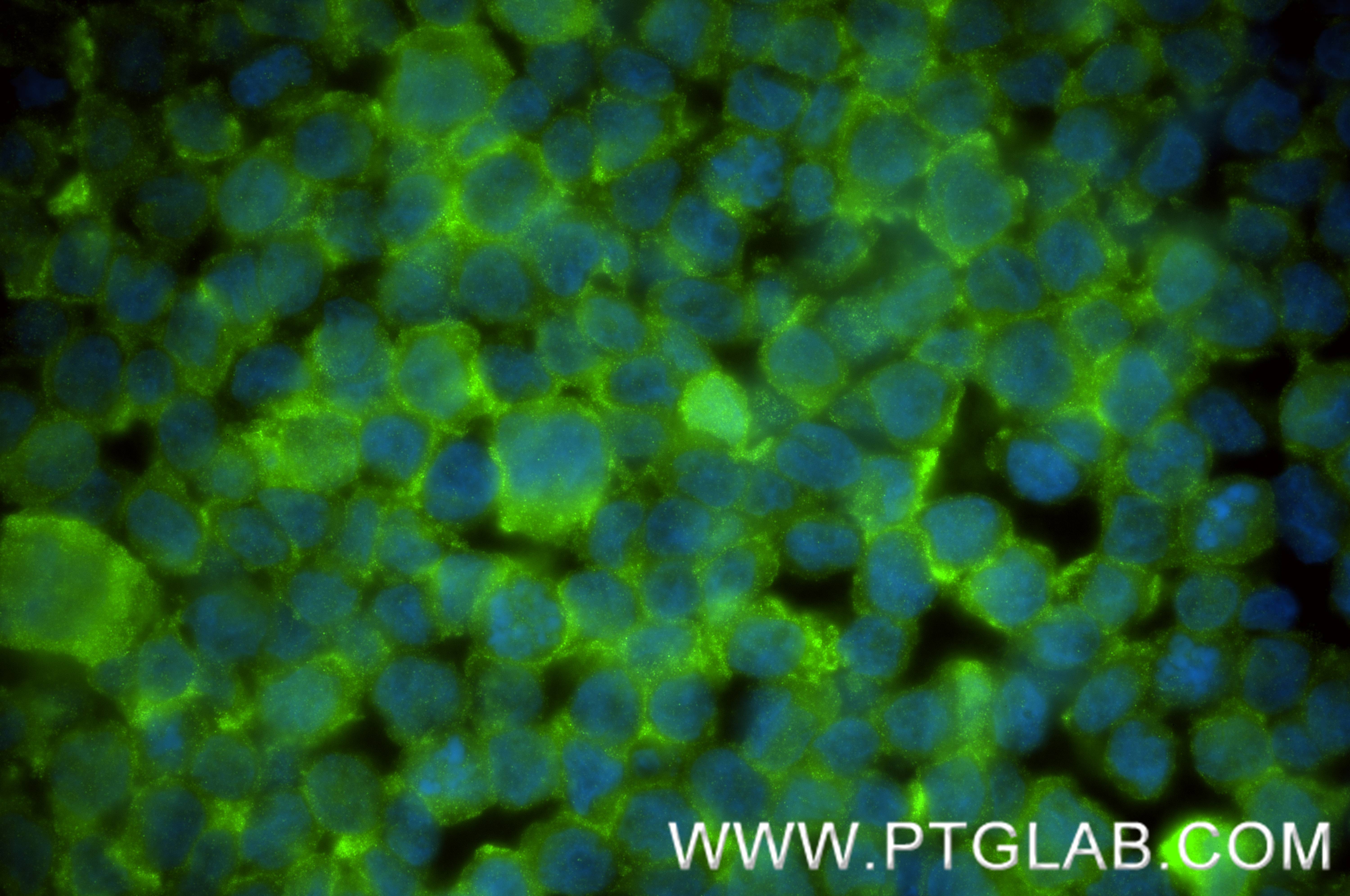 Immunofluorescent analysis of (4% PFA) fixed THP-1 cells using S100A8 antibody (82531-3-RR, Clone: 242970G12 ) at dilution of 1:200 and CoraLite®488-Conjugated Goat Anti-Rabbit IgG(H+L) (<a class='green' href='/productredirect?CatalogNo=SA00013-2' target='_blank'>SA00013-2</a>). IF Staining of THP-1 using 82531-3-RR