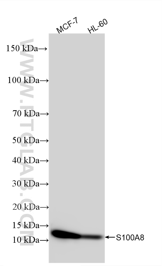 WB analysis using 82531-3-RR WB analysis using 82531-3-RR