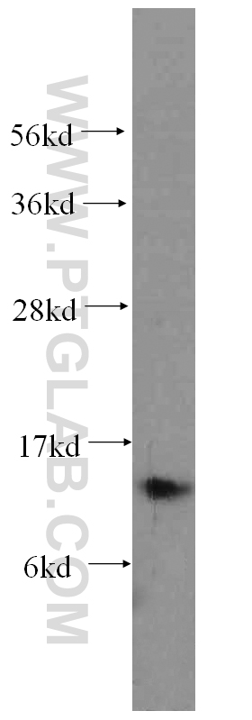 S100A9 Polyclonal antibody