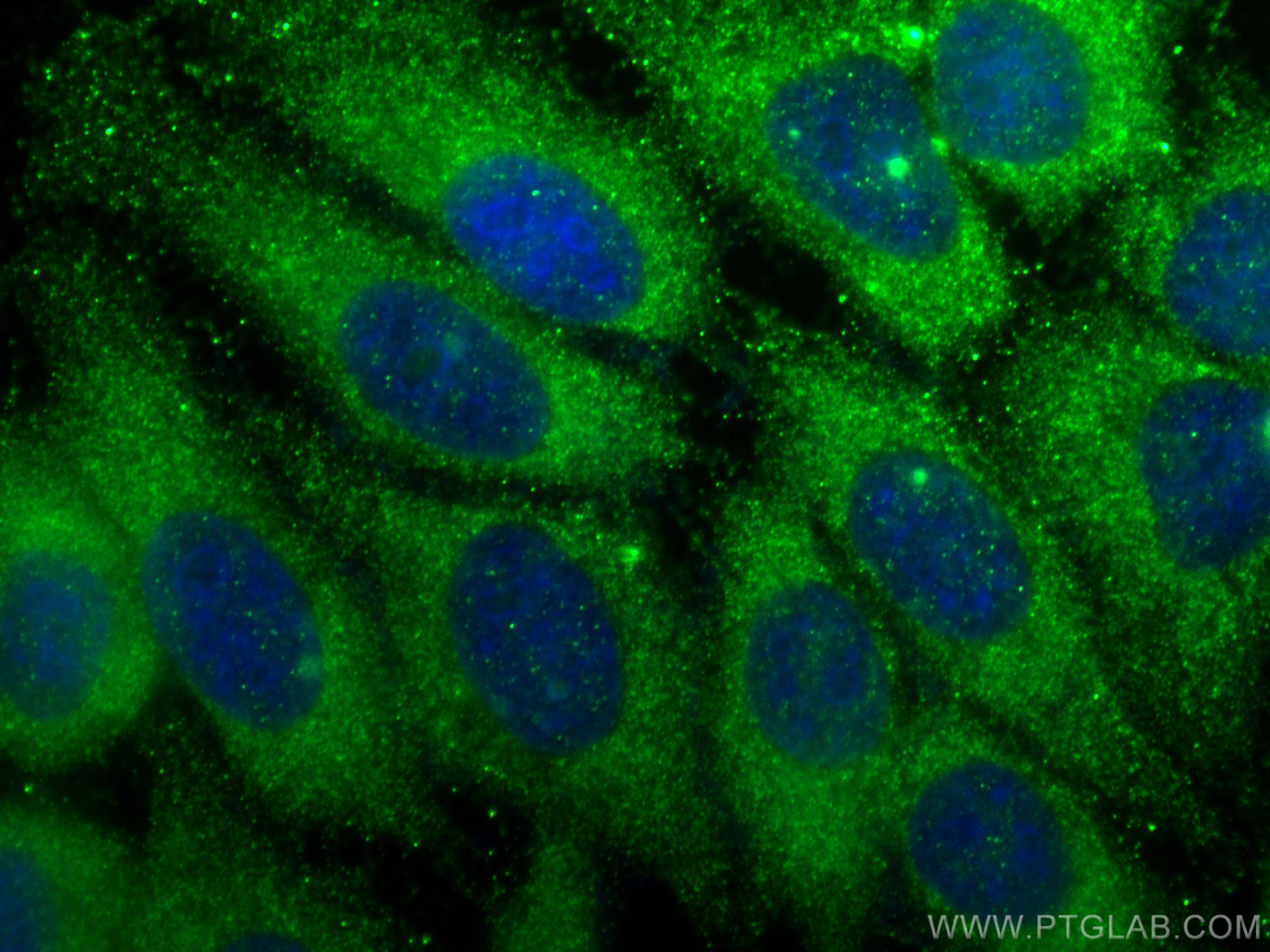 IF Staining of HepG2 using 26992-1-AP