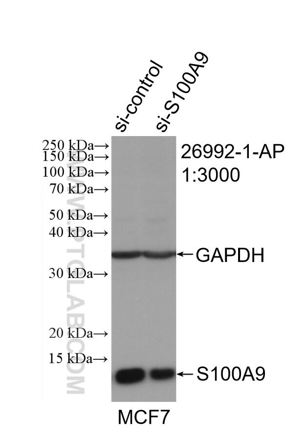 WB analysis of MCF-7 using 26992-1-AP