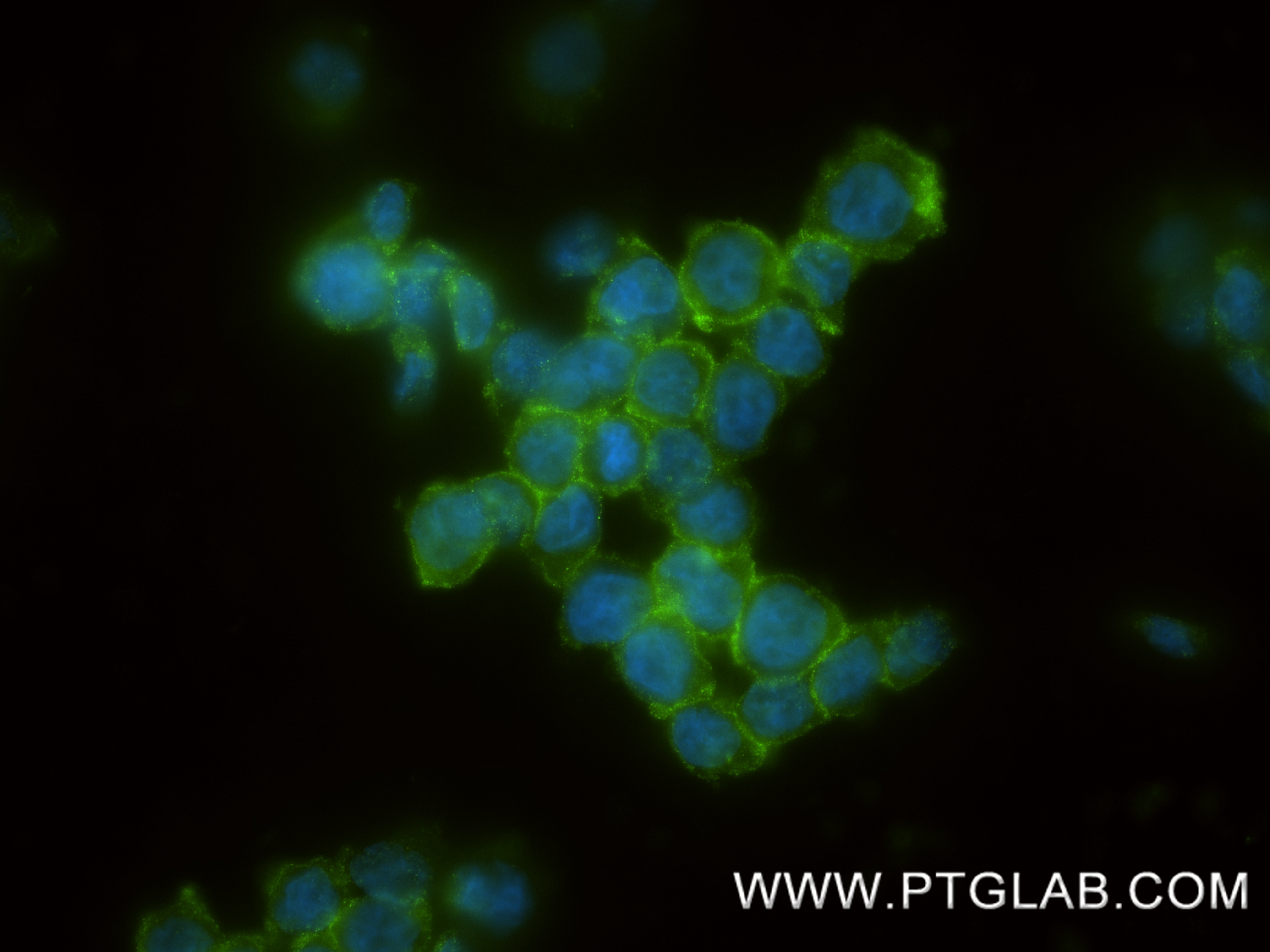 IF Staining of THP-1 using 83578-2-RR IF Staining of THP-1 using 83578-2-RR