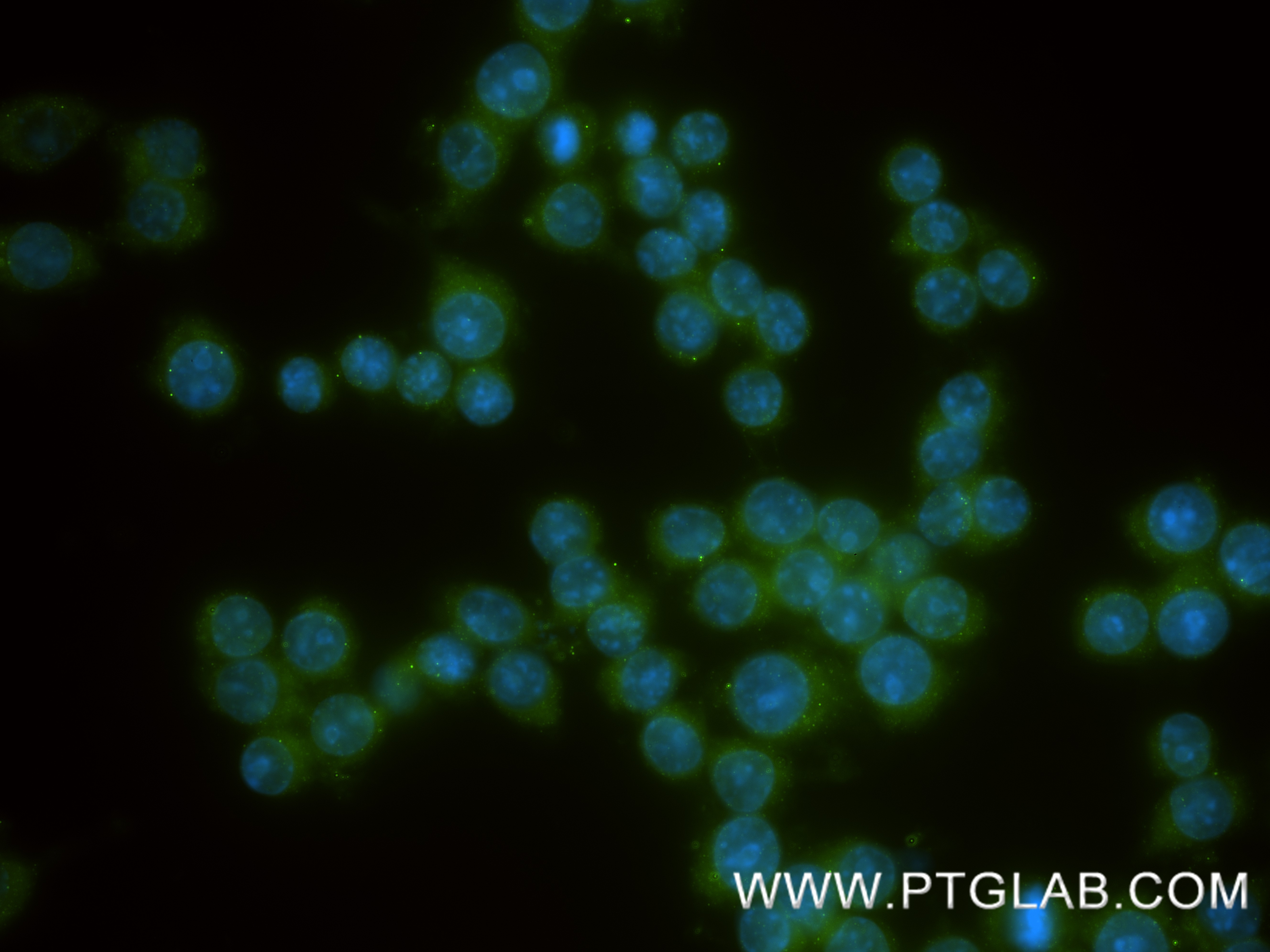 IF Staining of RAW 264.7 using 83578-2-RR IF Staining of RAW 264.7 using 83578-2-RR