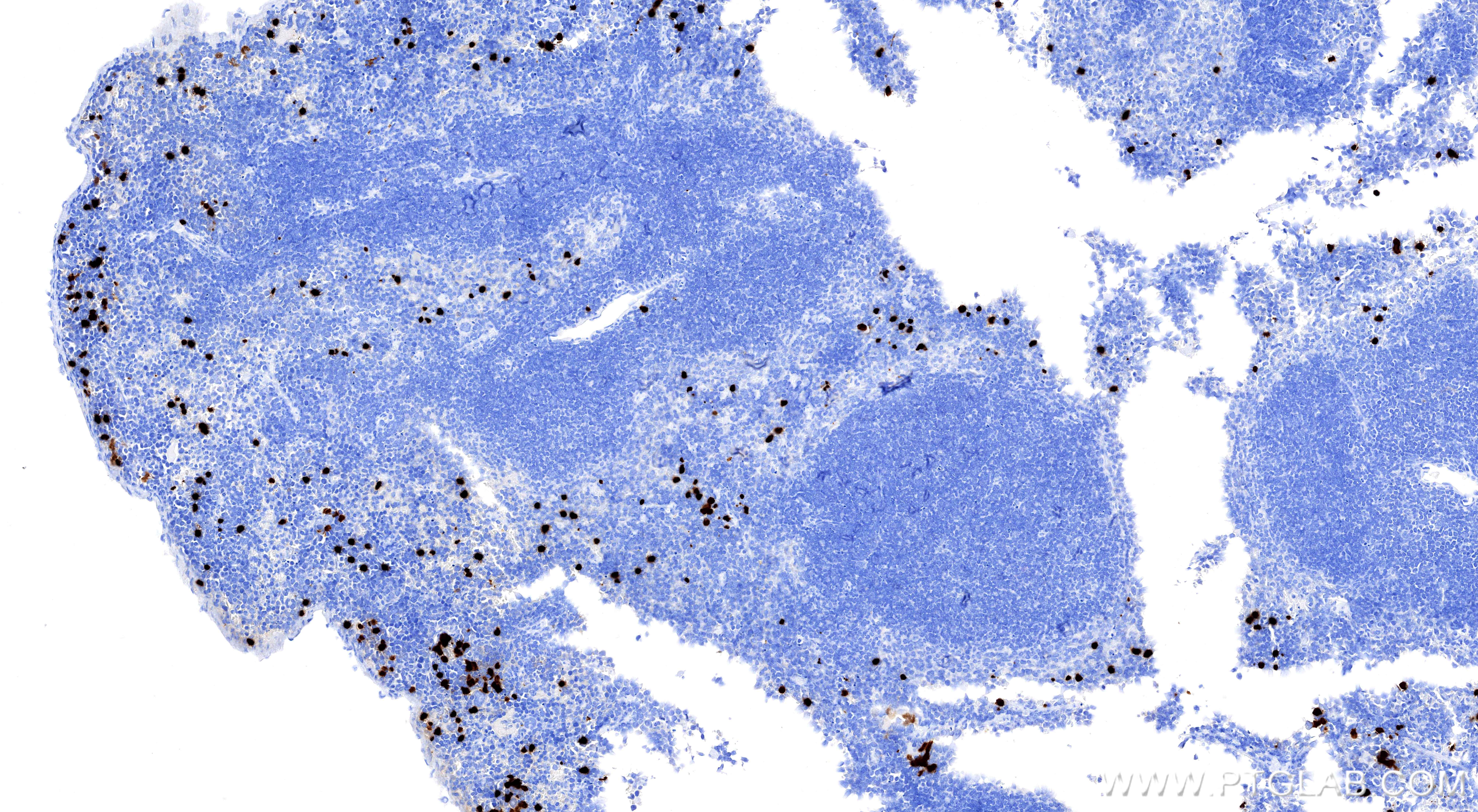 IHC staining of mouse spleen using 98505-5-RR