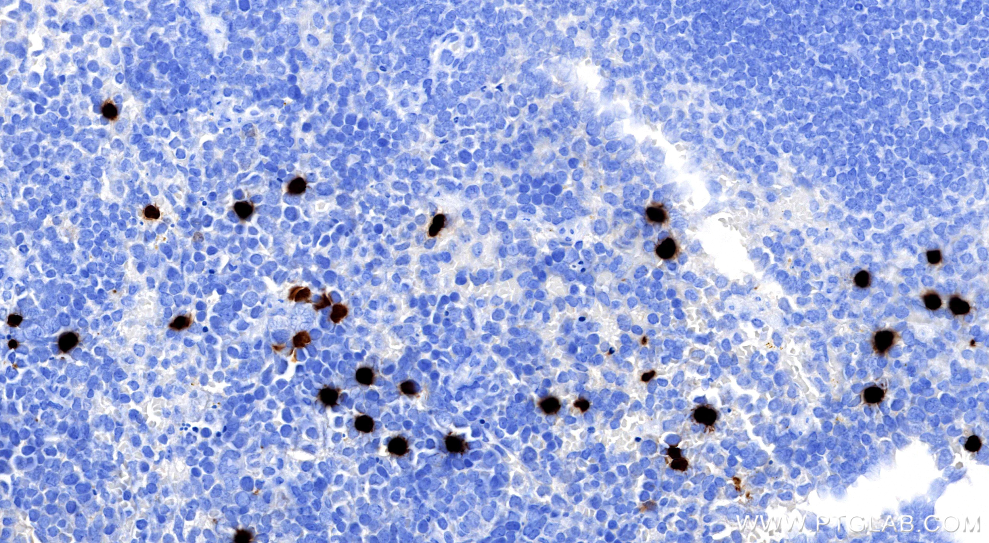 IHC staining of mouse spleen using 98505-5-RR