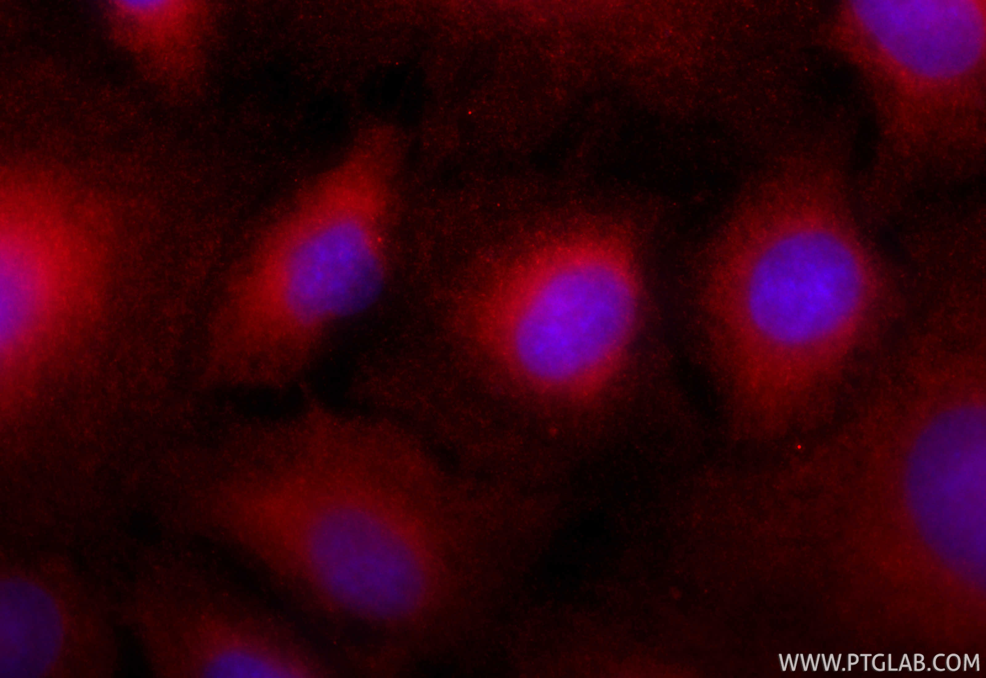 IF Staining of A549 using CL594-26992