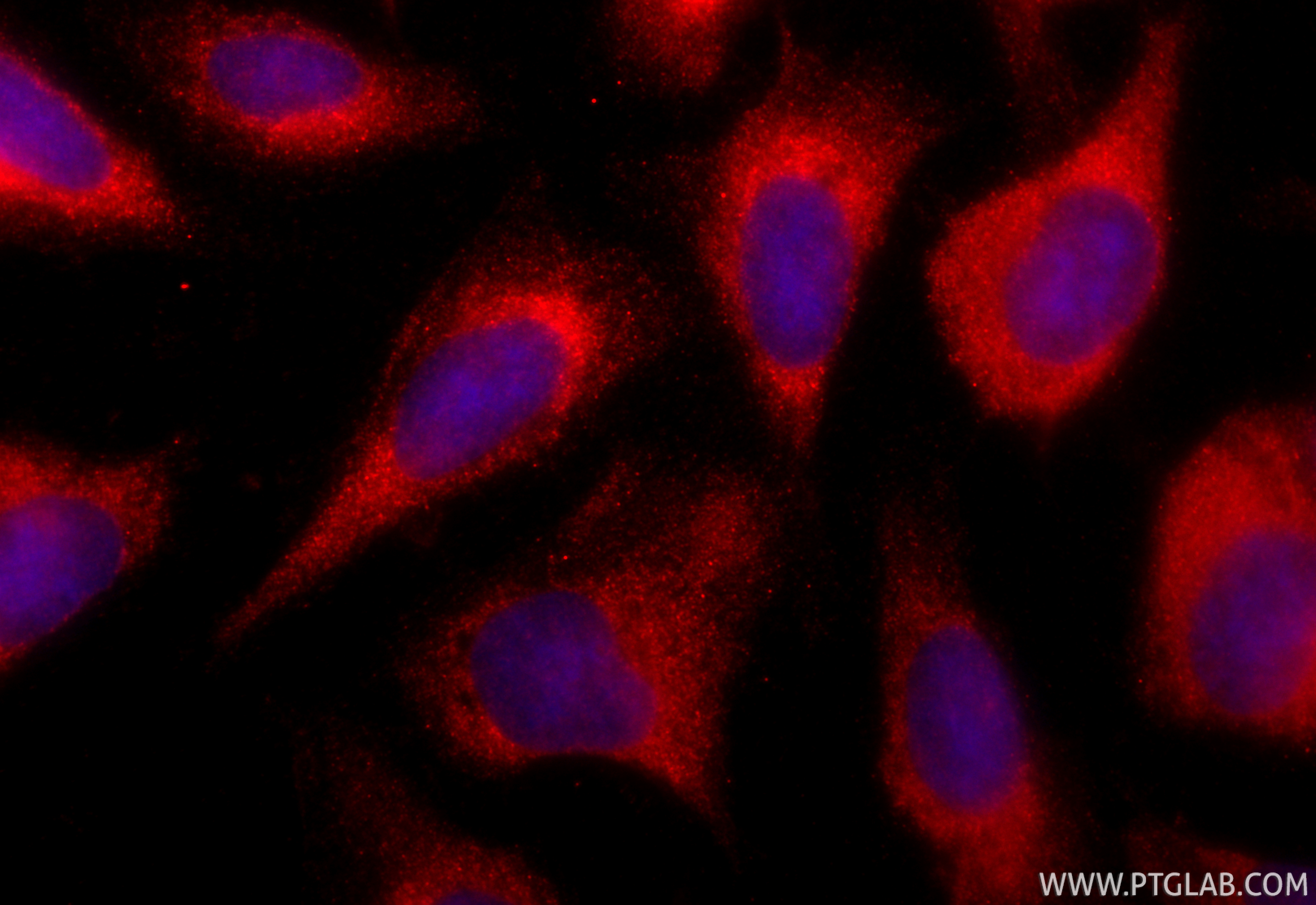 IF Staining of U2OS using CL594-26992