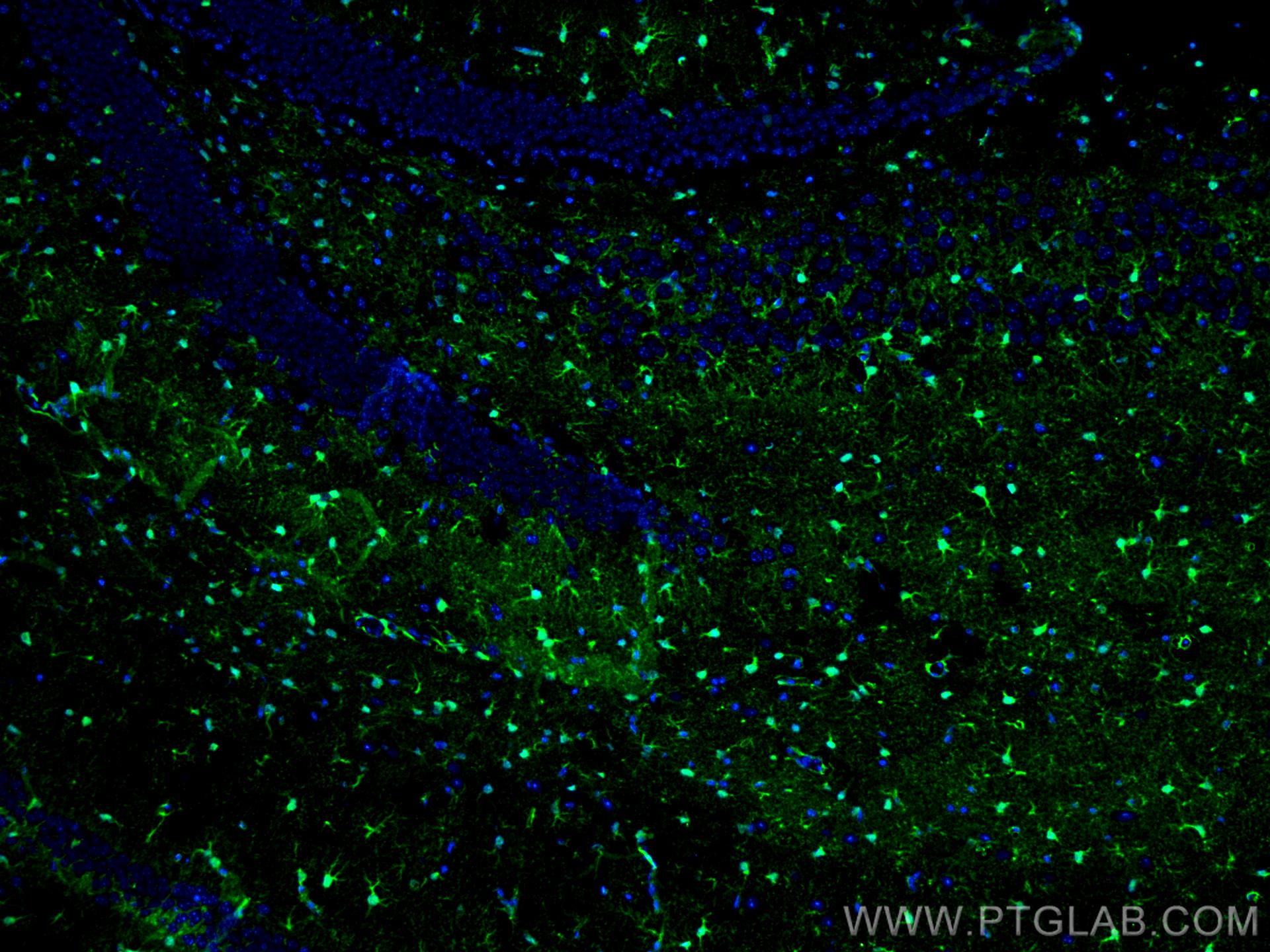 IF Staining of mouse brain using 15146-1-AP