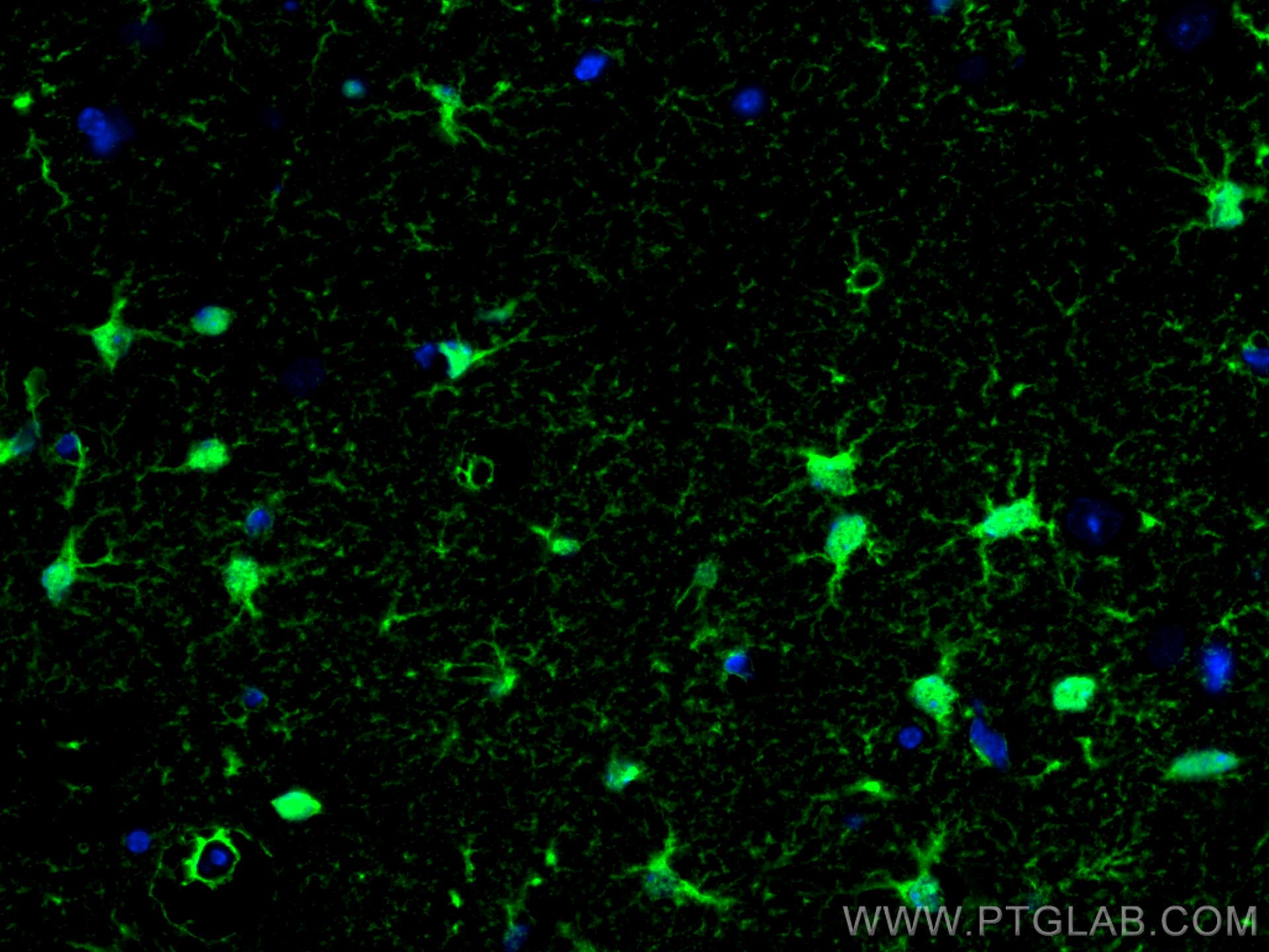IF Staining of mouse brain using 15146-1-AP